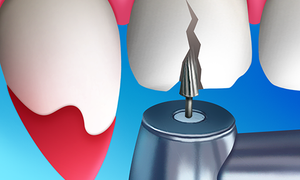 Dentist Bling Mod Apk 0.6.0 Unlimited Money
